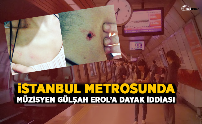 İstanbul Metrosunda müzisyen Gülşah Erol'a dayak iddiası